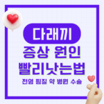 눈다래끼 초기증상 원인 전염 약 찜질 빨리 낫는 법 병원 수술 방법 총정리